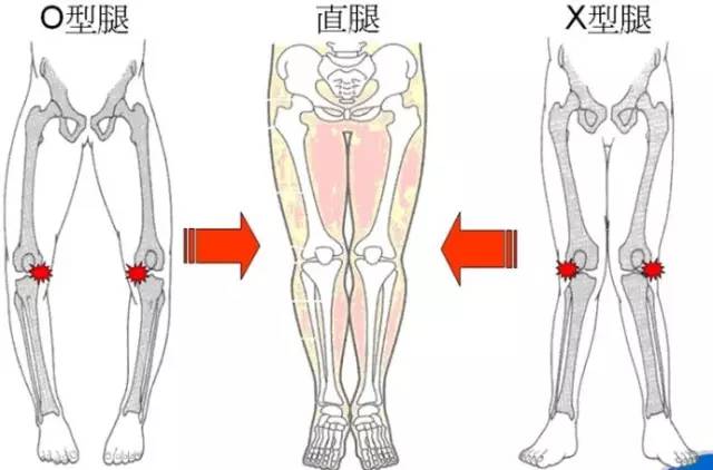 身体健康大腿_大腿质量_大腿的问题